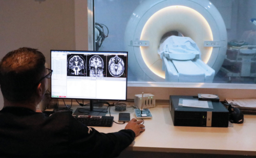 Linha de pesquisa busca novas formas de tratamento e prevenção da epilepsia