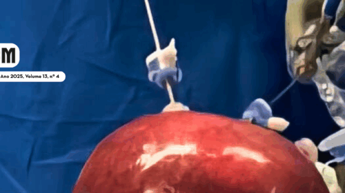 Avanços tecnológicos das cirurgias pediátricas minimamente invasivas