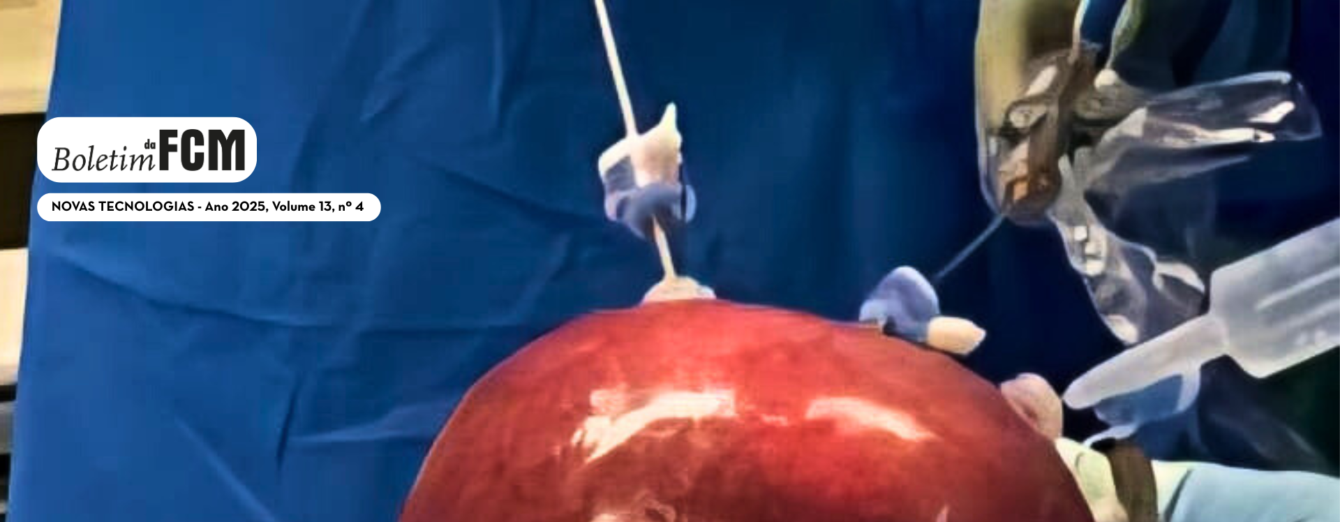 Avanços tecnológicos das cirurgias pediátricas minimamente invasivas